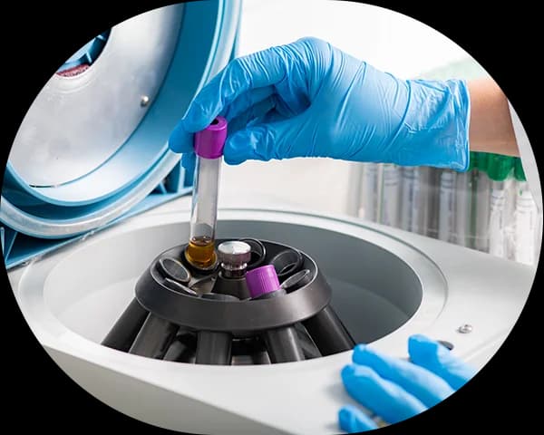 A stable centrifugation system