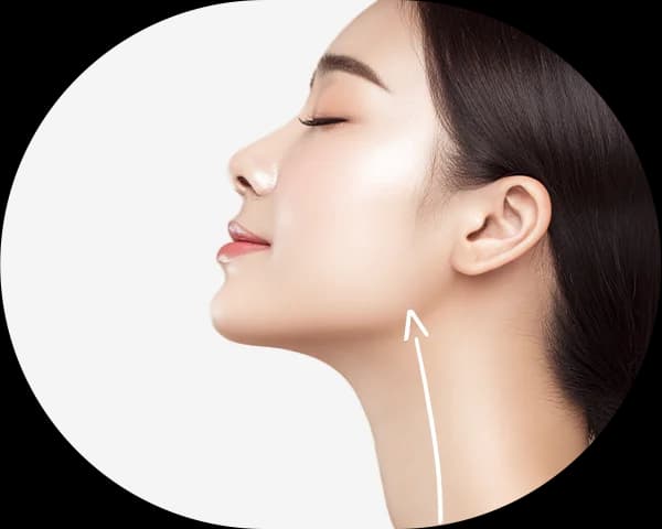목선을 따라 턱 쪽으로 향하는 당김 방향을 화살표로 표시한 옆모습 일러스트