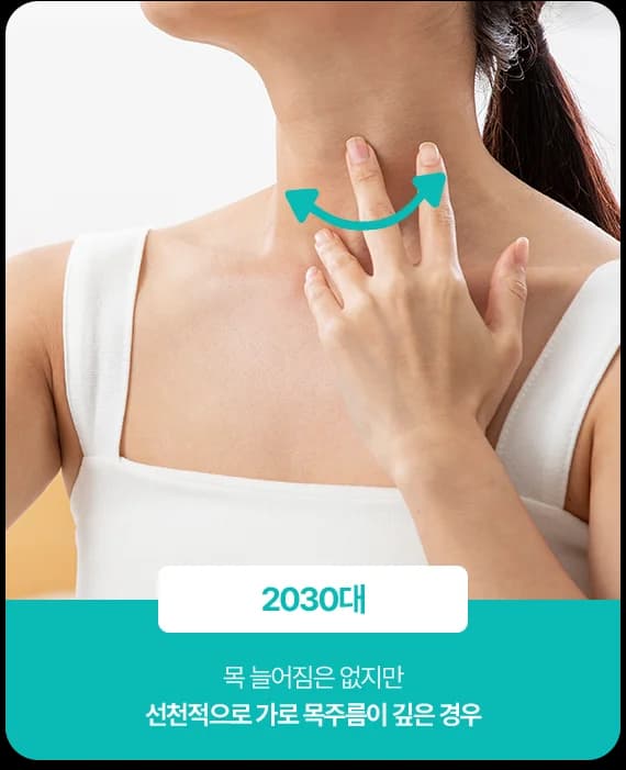 목 늘어짐 없이 선천적으로 가로 목주름이 깊은 2030대 유형을 보여주는 사진 카드