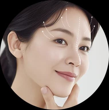 이마와 눈가에서 위쪽으로 향하는 거상 방향을 점선 화살표로 표시한 얼굴 사진